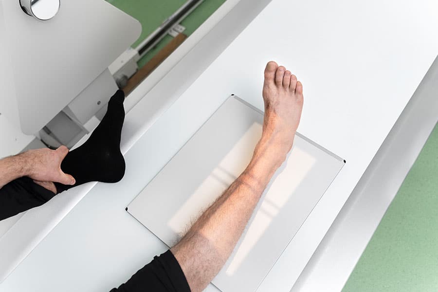 X-ray of the foot to check the condition of the talus