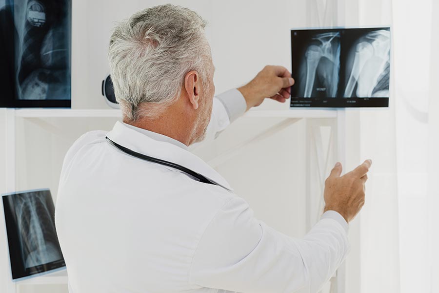 Analyse de la radiographie de l'épaule